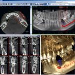 xray2